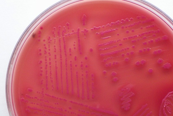 This photo shows colonies of microorganisms forming on an agar plate petri dish.