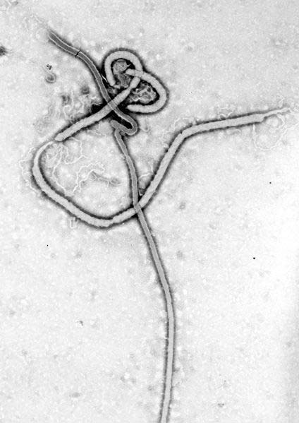 This image is a transmission electron micrograph of the Ebola Virus.