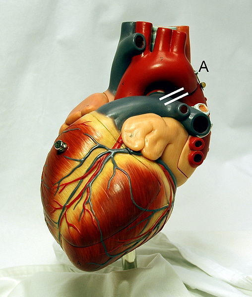 This photo shows a heart model on display. The position of a ductus arteriosus is drawn between the aorta and pulmonary artery.