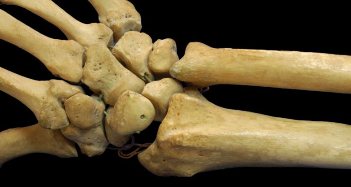 This photo shows a close up view of the radius and ulna bones that make up part of the human arm and the overall human skeleton.