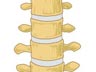 Lower spine picture