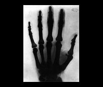 X-ray of Tesla's hand