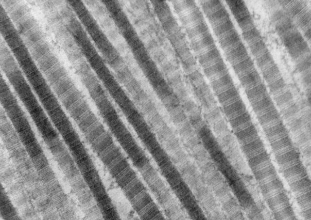 A highly detailed electron microscope image of collagen fibers found in the lung.
